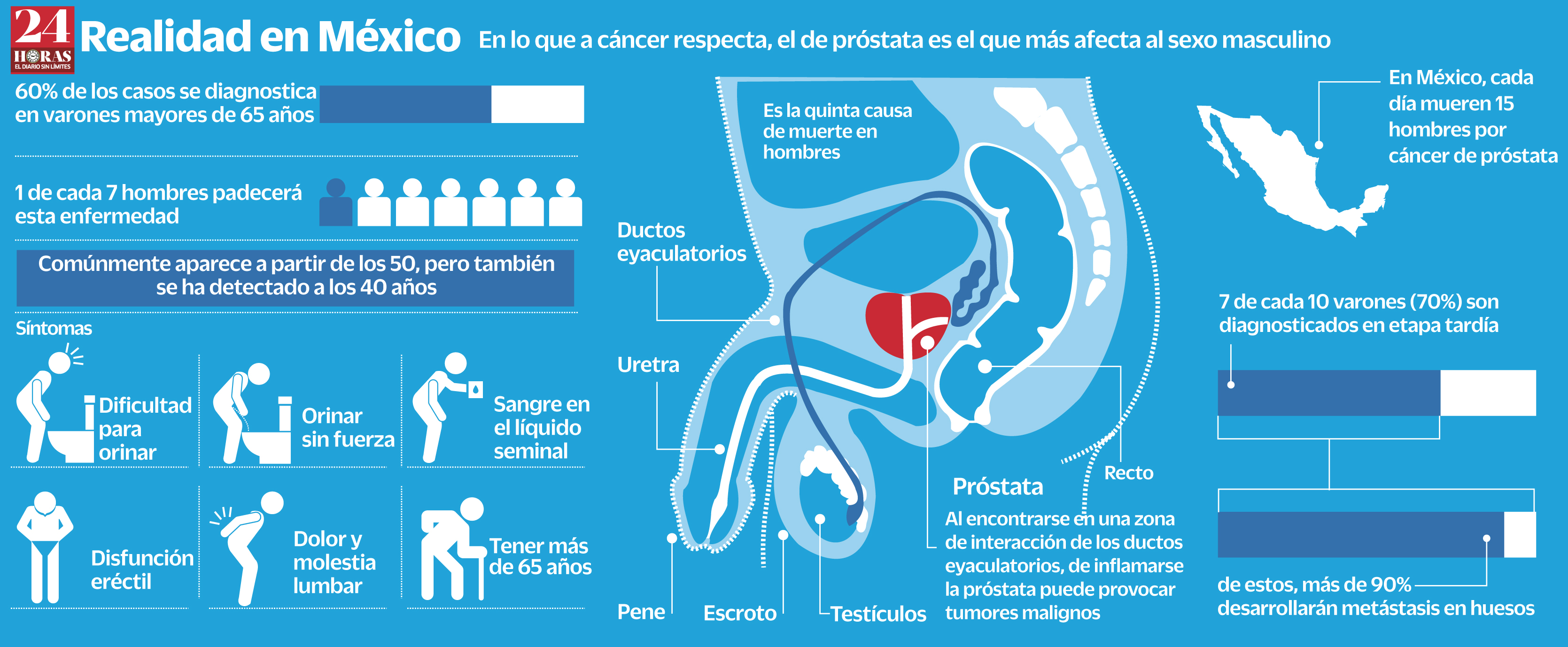 Alimentos prohibidos para personas con cáncer de próstata