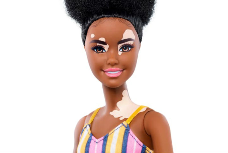 Barbie se vuelve más inclusiva; lanzan muñeca sin cabello y otra con vitiligo. Noticias en tiempo real