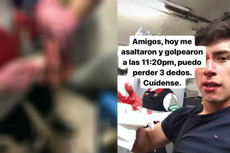 Estudiante de IPN sufre violento asalto afuera de Metro Tacuba; casi pierde tres dedos. Noticias en tiempo real