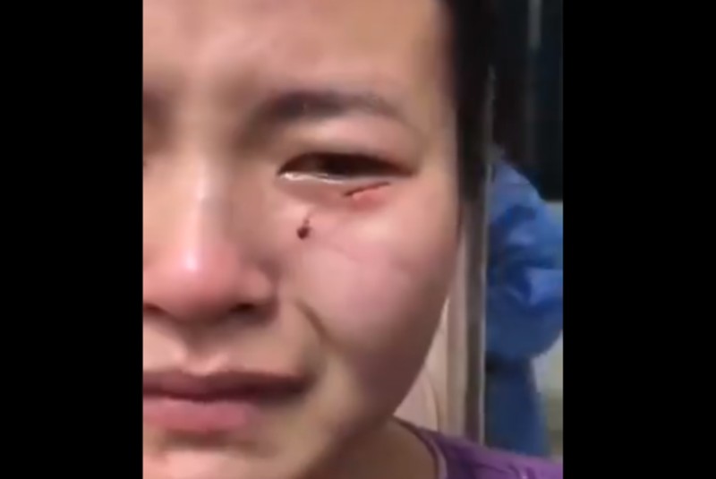 Paciente con Covid-19 muerde y golpea a enfermera para tratar de huir del hospital (+video). Noticias en tiempo real