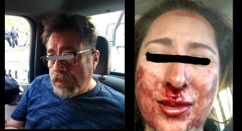 Detienen a notario que agredió a su esposa en la vía pública (+fotos). Noticias en tiempo real