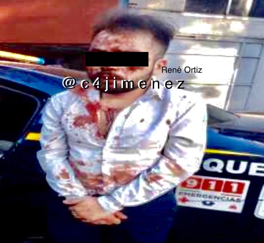 Foto: @c4jimenez | René fue identificado el conductor que esta mañana atropelló ebrio a un grupo de ciclistas