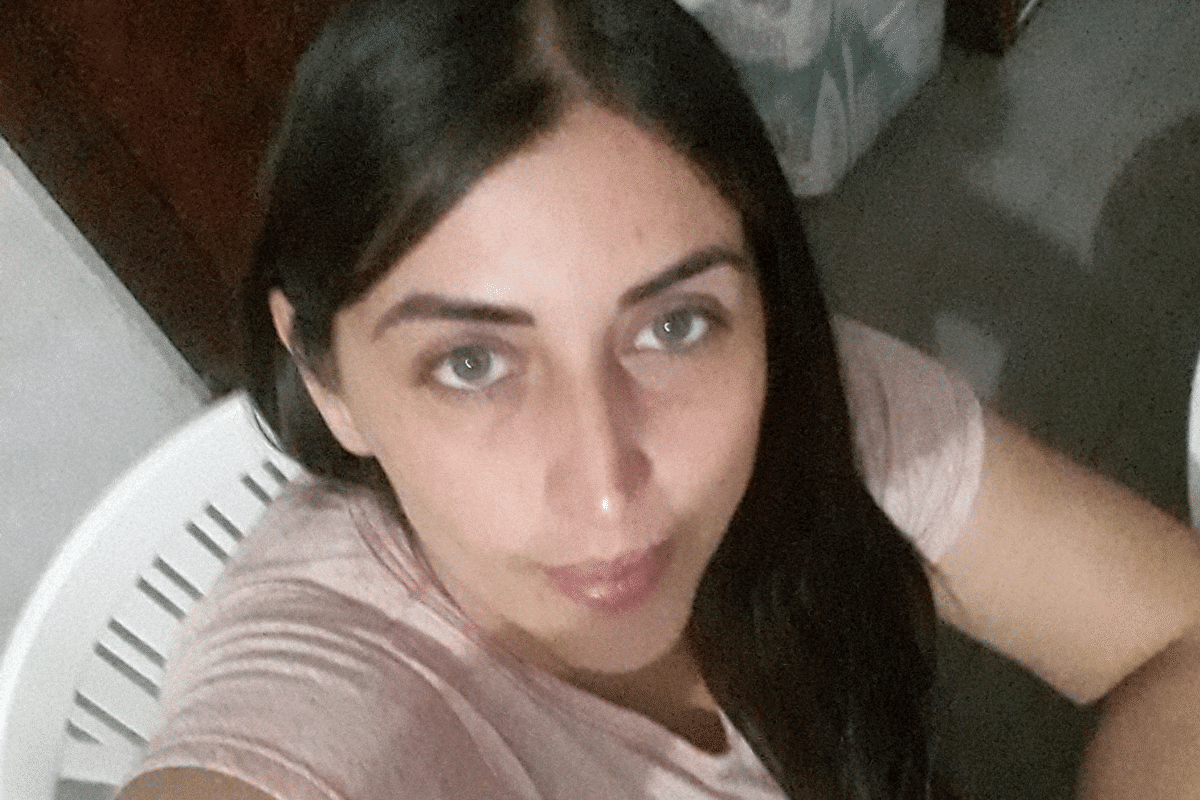 Foto: Facebook/ @Claudia Serran | Mujer asegura haber perdido el cartílago de su nariz por una PCR mal realizada, ahora pide ayuda para reconstrucción