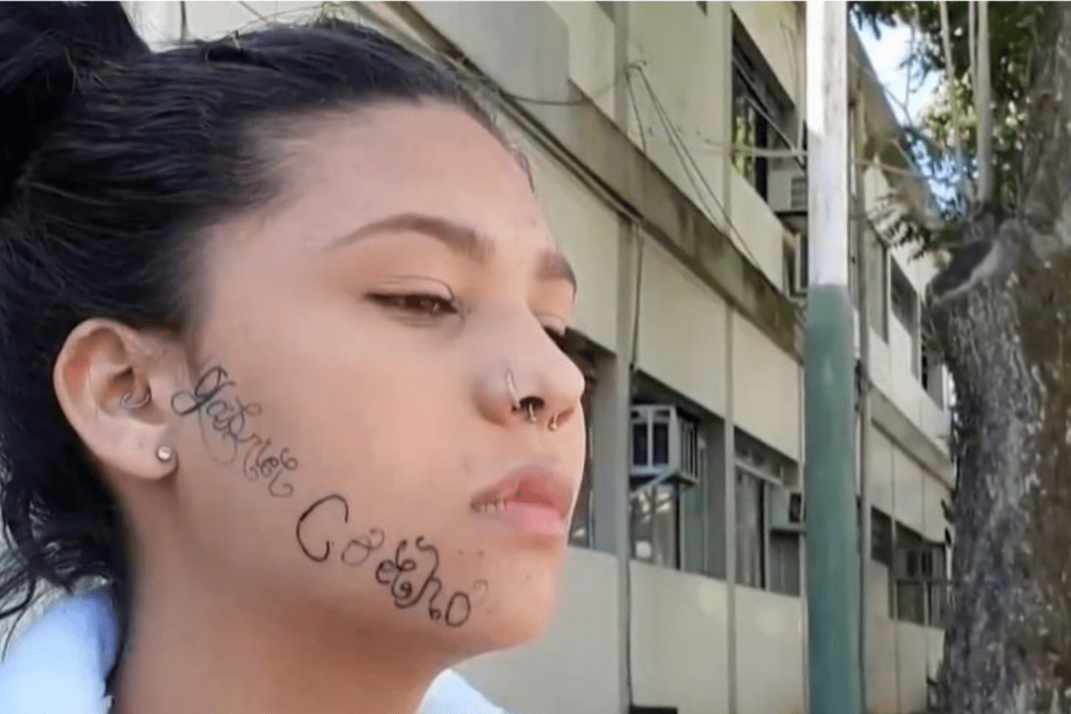 Foto: Twitter/ @UOL | Joven secuestrada y obligada a tatuarse el nombre de su ex en la cara comienza a borrarlo