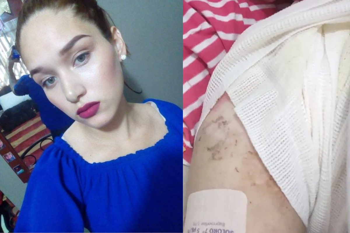 Foto: Facebook/ @Liliana Fernández | “No sentir tanto el dolor”: Joven de N.L fue abusada y quemada viva, ahora pide ayuda 
