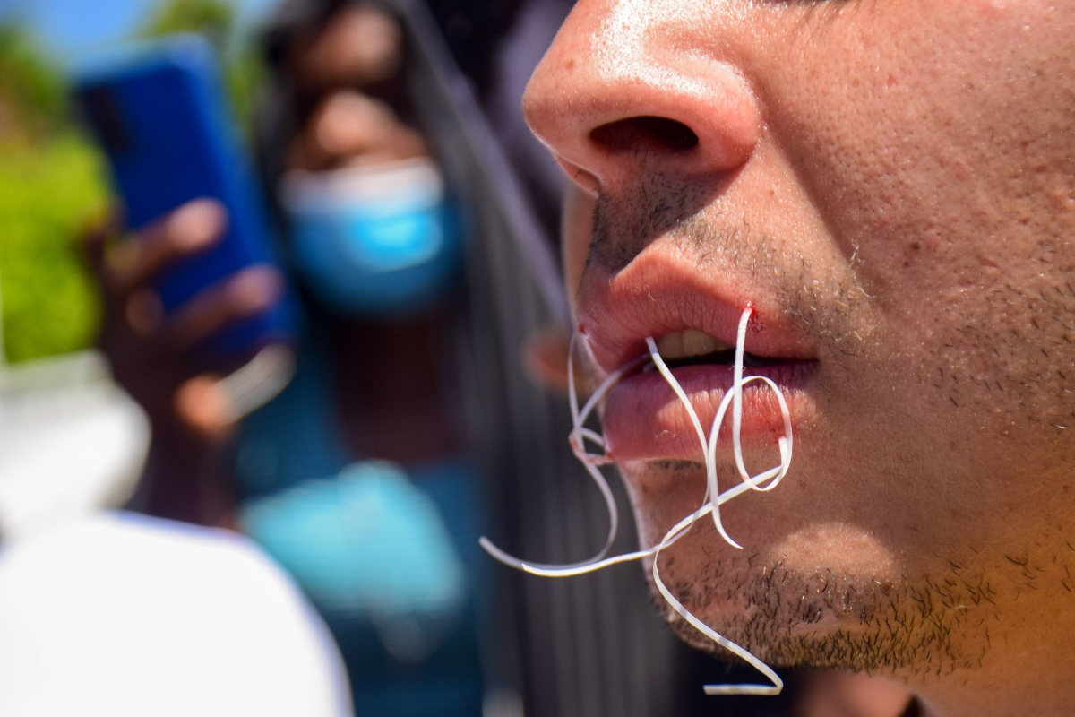 Migrantes cosen sus labios a modo de protesta.