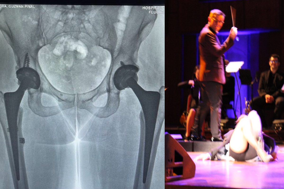 Foto: Instagram | @Alejandra Guzmán | “Todo en su lugar”: Alejandra Guzmán muestra radiografías tras dislocarse la cadera
