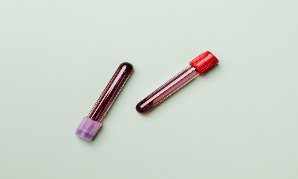 tubos de laboratorio que contienen sangre