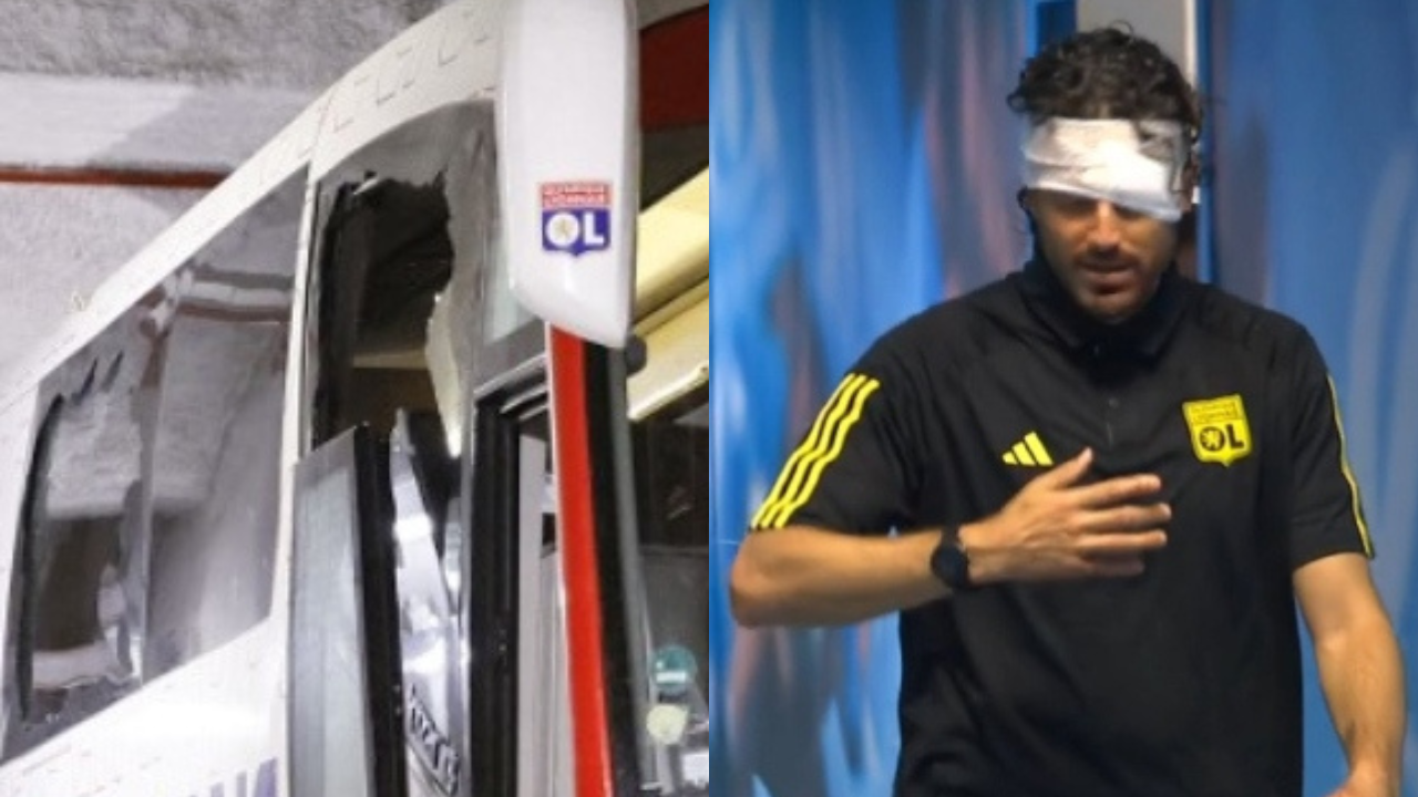 Hinchas del Marsella atacan el autobús de Lyon y hieren a su DT, Fabio Grosso
